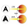 贵阳散光治疗