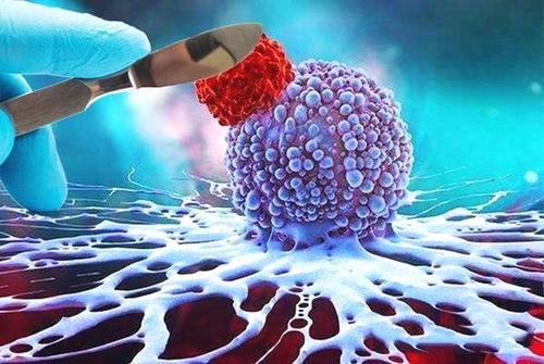 贵阳癌症中医哪里好